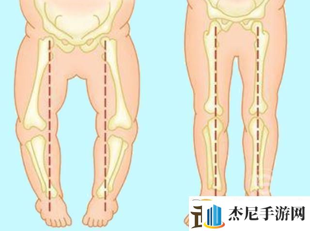 宝宝腿交叉网民热议的奇异现象